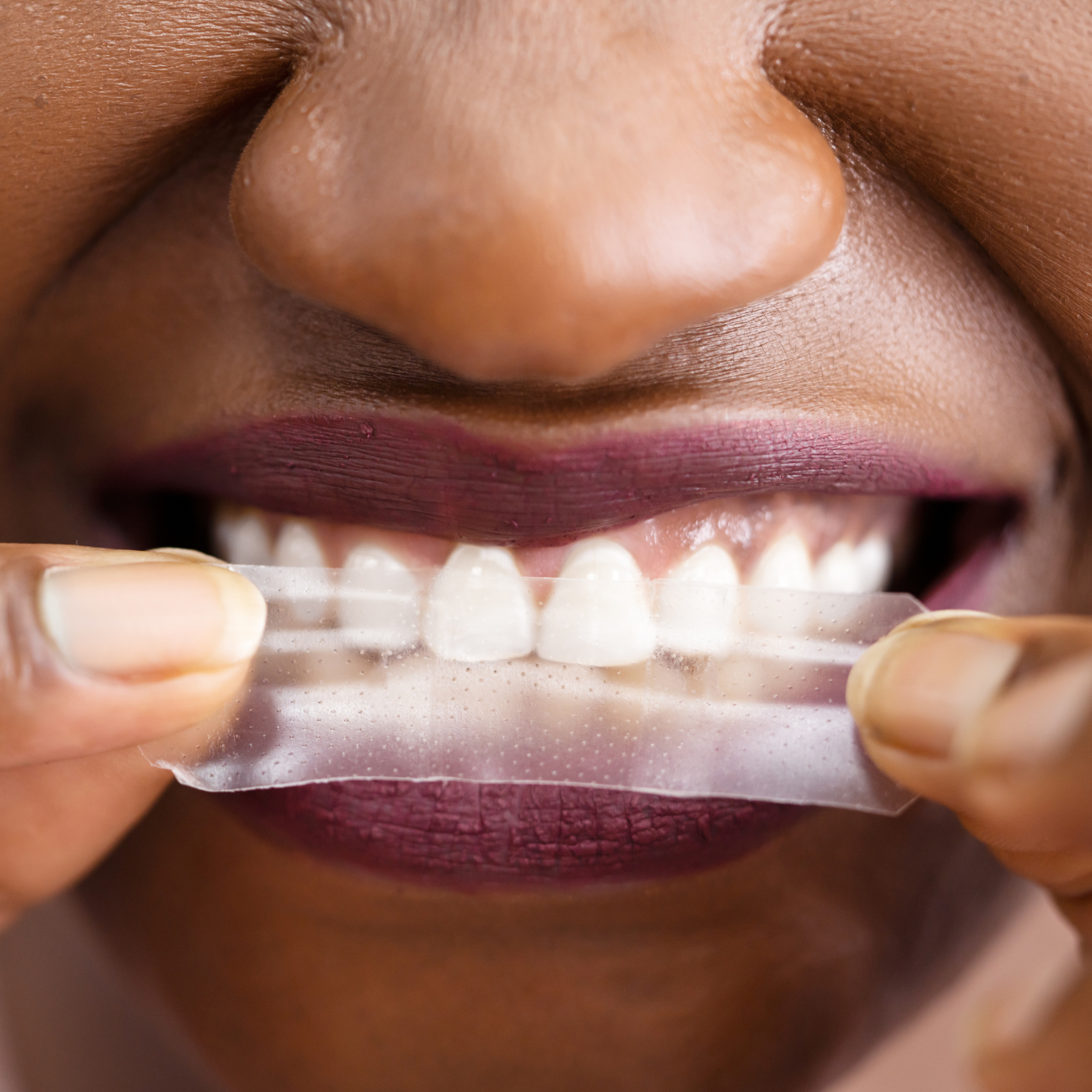 The Best Teeth Whitening Products for Sensitive Teeth – Achieve a Brighter Smile Naturally with Real White Teeth Whitening Pens and Strips