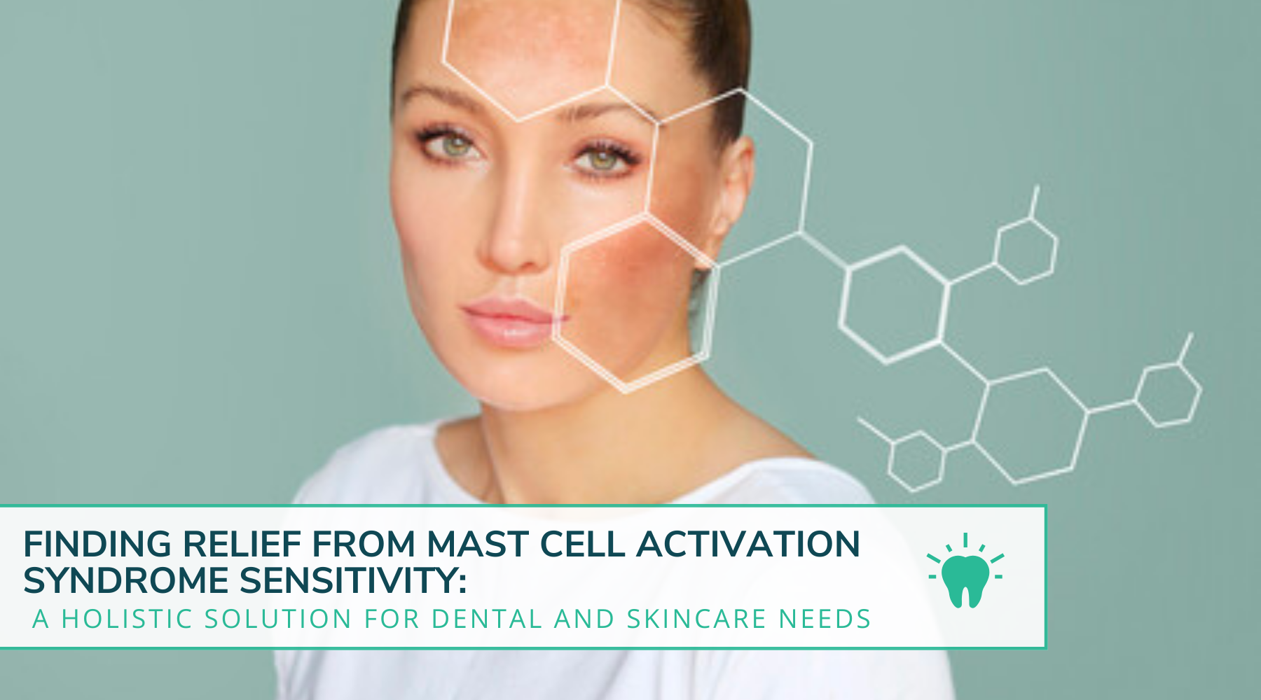 Finding Relief from Mast Cell Activation Syndrome Sensitivity: A Holistic Solution for Dental and Skincare Needs