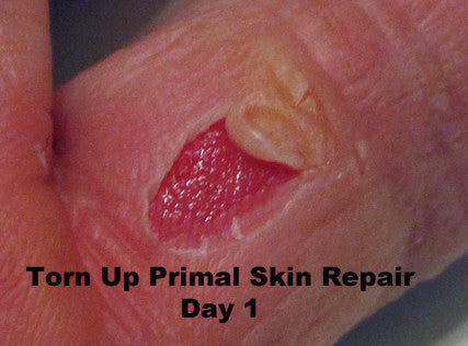 Torn Up Skin Repair