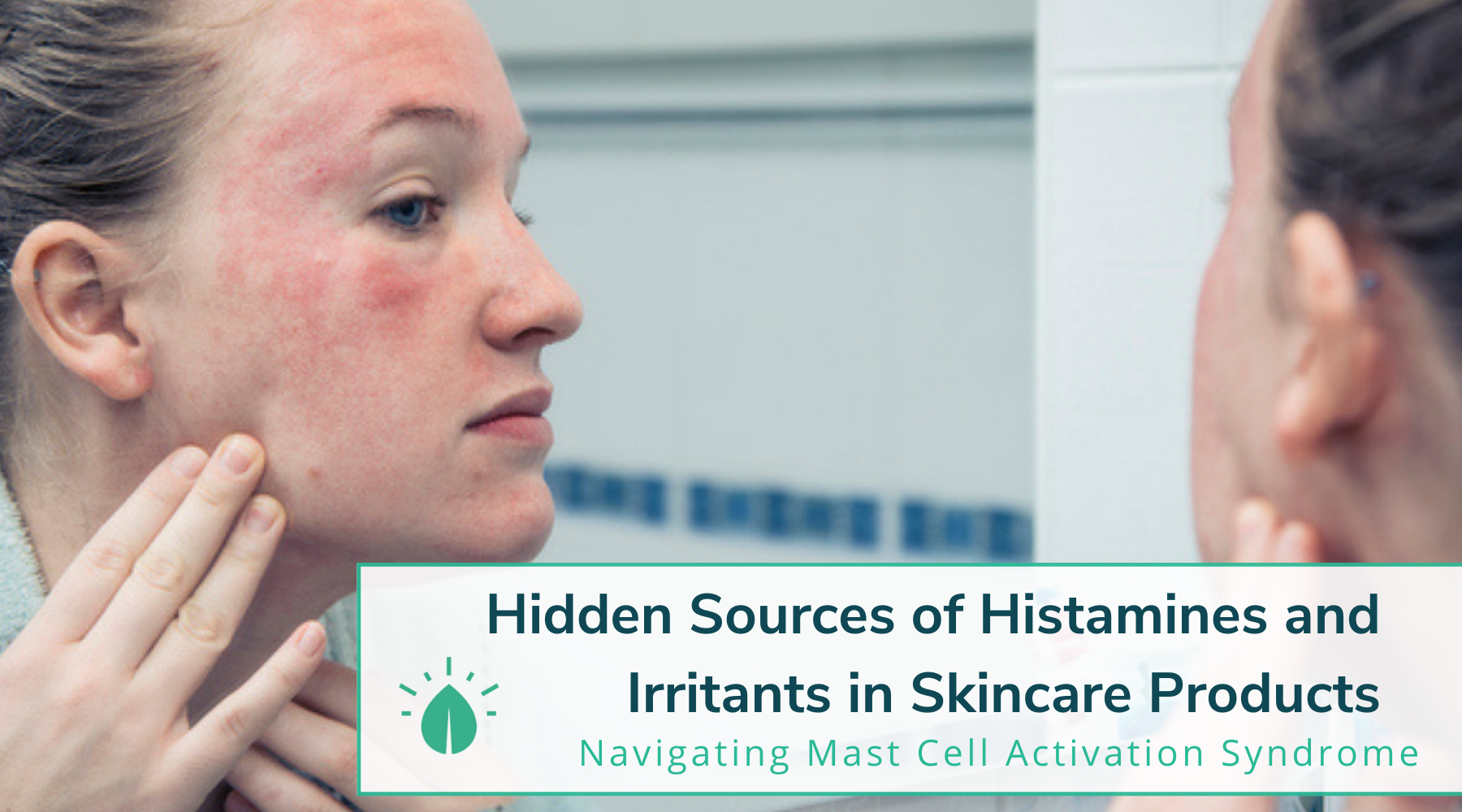 Hidden Sources of Histamines and Irritants in Skincare Products: Navigating Mast Cell Activation Syndrome