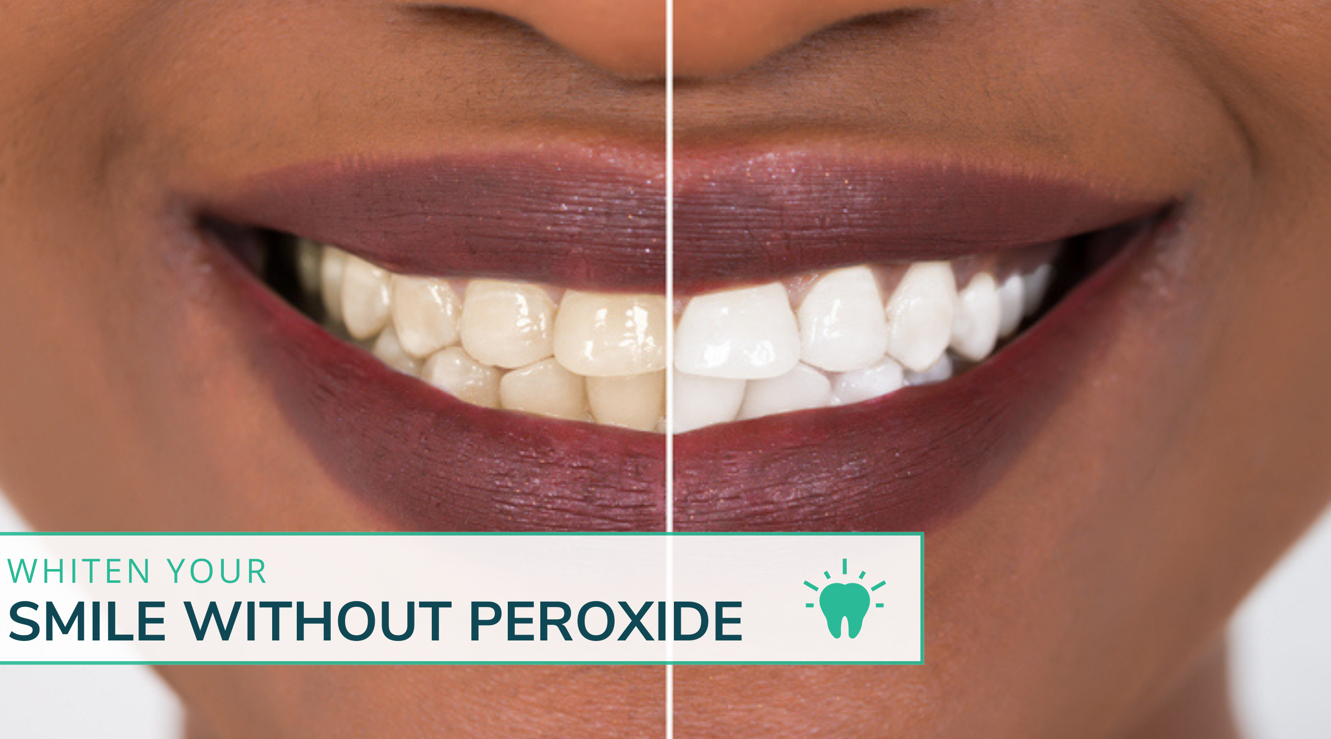 Whiten Your Smile Without Peroxide!