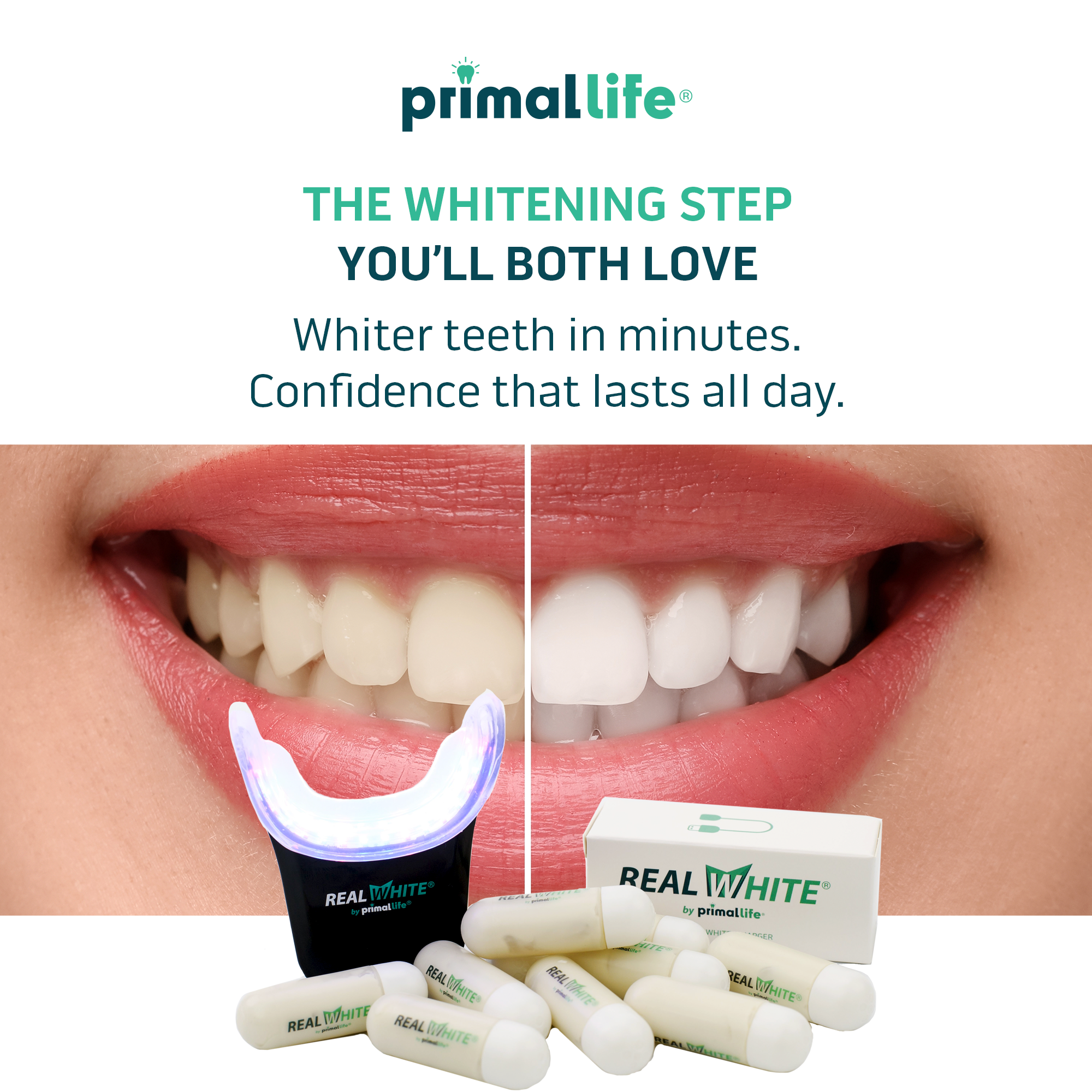 His & Hers Whitening Duo