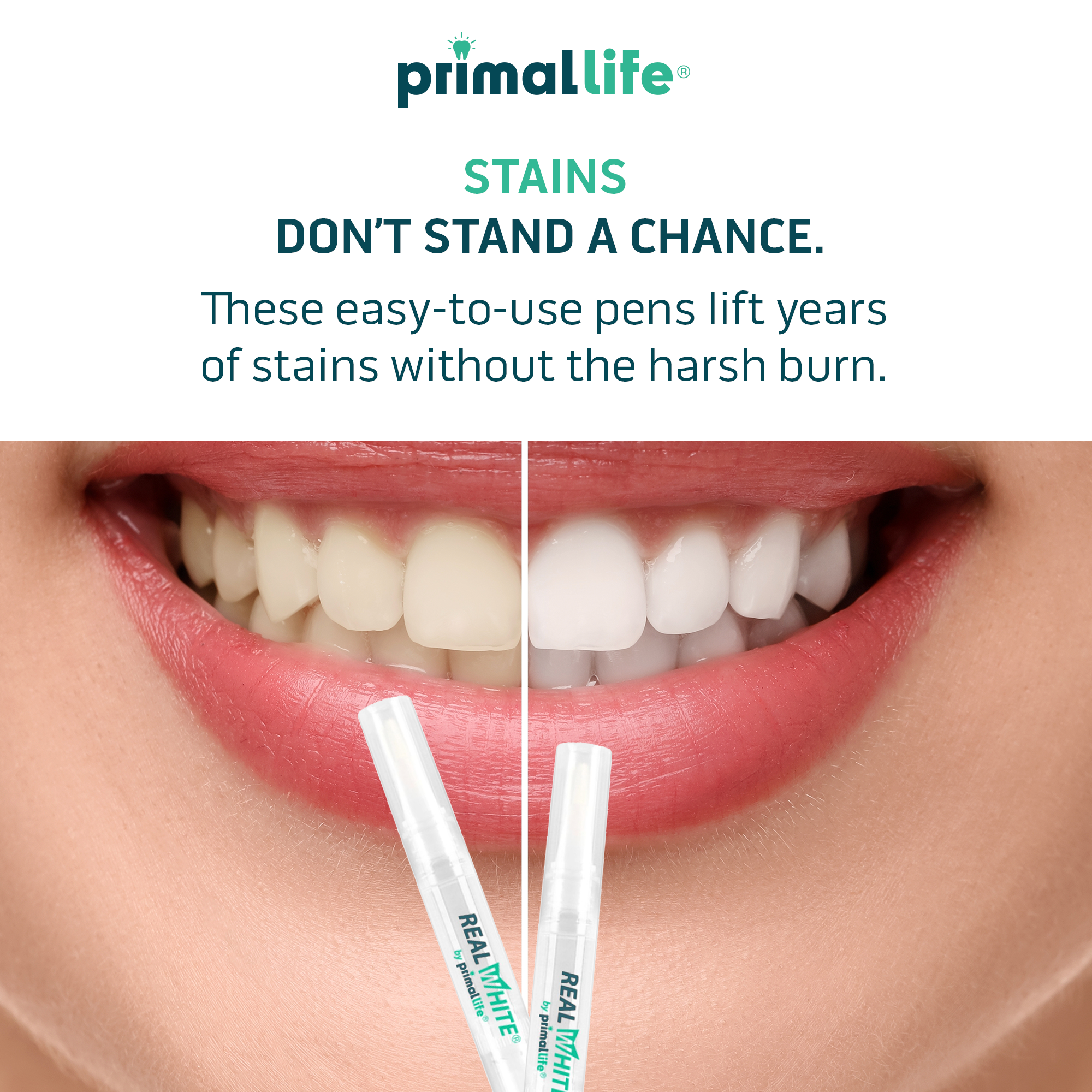 LED Whitening Refill Pack