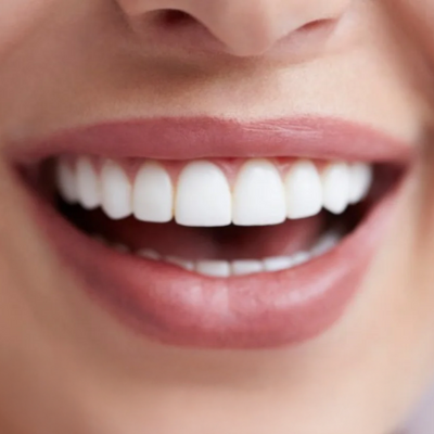 Toothpaste Chews!