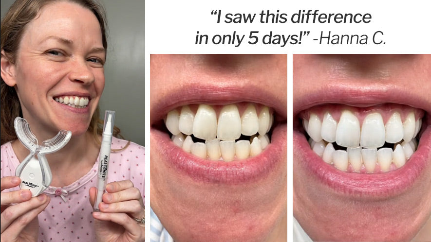 Before and After
