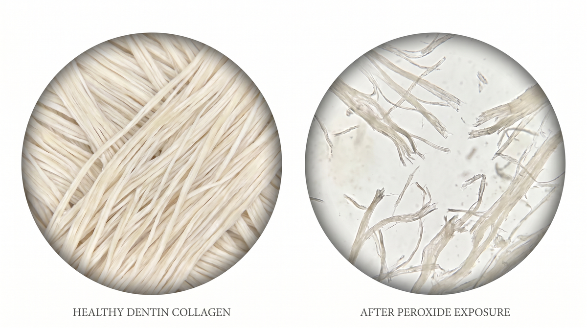 Tooth enamel damage illustration