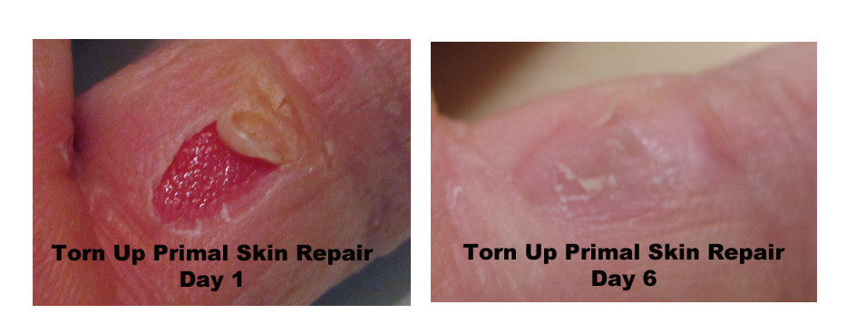 Torn Up Skin Repair